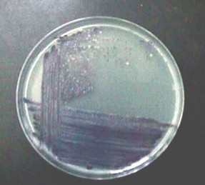 sepsis_Chromobacterium_violaceum/hemocultivo_subcultivo_agar sepsis_Chromobacterium_violaceum/hemocultivo_subcultivo_agar