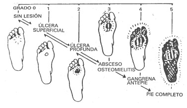 atencion_primaria_diabetes/grados_clasificacion_wagner