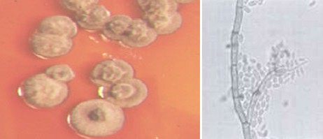 feohifomicosis_subcutanea_micoabsceso/microbiologia_cultivo