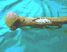 hidroxiapatita_coralina_fracturas/refuerzo_oseo_interno hidroxiapatita_coralina_fracturas/refuerzo_oseo_interno