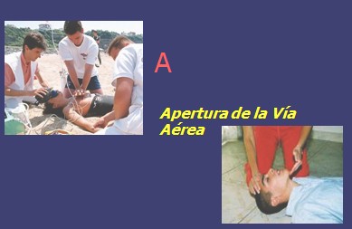 resucitacion_cardiopulmonar_avanzada/apertura_via_aerea resucitacion_cardiopulmonar_avanzada/apertura_via_aerea