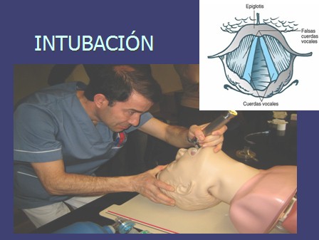 resucitacion_cardiopulmonar_avanzada/intubacion_orotraqueal_IOT