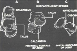 talon_pie_diabetico/descripcion_anatomica_anatomia talon_pie_diabetico/descripcion_anatomica_anatomia