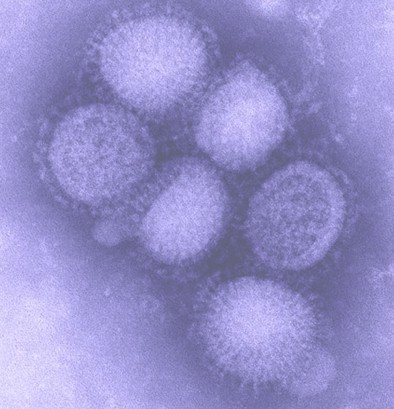 profilaxis_tratamiento_AH1N1/virus_gripe_porcina