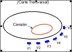 ECG_electrocardiografia_basica/corte_precordiales_unipolares ECG_electrocardiografia_basica/corte_precordiales_unipolares