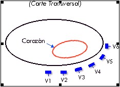 ECG_electrocardiografia_basica/corte_precordiales_unipolares