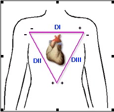 ECG_electrocardiografia_basica/derivaciones_bipolares_clasicas