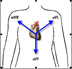 ECG_electrocardiografia_basica/derivaciones_unipolares_miembros