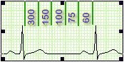 ECG_electrocardiografia_basica/determinacion_frecuencia_cardiaca