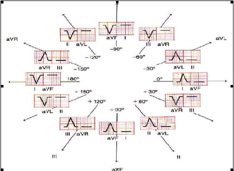 ECG_electrocardiografia_basica/eje_electrico_corazon ECG_electrocardiografia_basica/eje_electrico_corazon