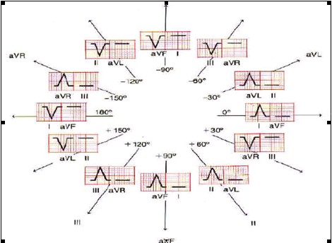 ECG_electrocardiografia_basica/eje_electrico_corazon