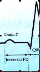 ECG_electrocardiografia_basica/examen_onda_p