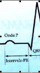 ECG_electrocardiografia_basica/grafico_onda_p