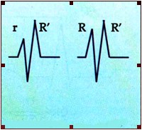 ECG_electrocardiografia_basica/grafico_onda_r