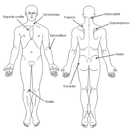 fibromialgia_sindrome_fibromialgico/tender_points_exploracion