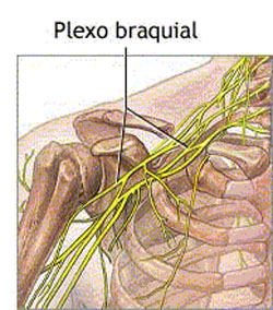 hernia_disco_lumbar/plexo_braquial_axila hernia_disco_lumbar/plexo_braquial_axila