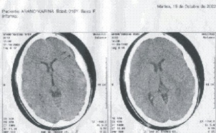 sindrome_confusional_encefalitis/TAC_RMN_imagen sindrome_confusional_encefalitis/TAC_RMN_imagen