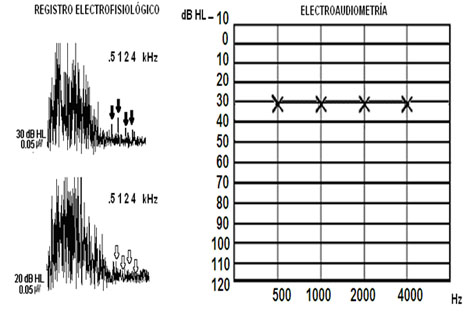 evaluacion_objetiva_audicion/anexo_2_electroaudiometria evaluacion_objetiva_audicion/anexo_2_electroaudiometria