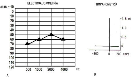 evaluacion_objetiva_audicion/anexo_3_electroaudiometria evaluacion_objetiva_audicion/anexo_3_electroaudiometria