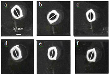 simvastatina_contraccion_acetilcolina/medidas_anillos_traqueales