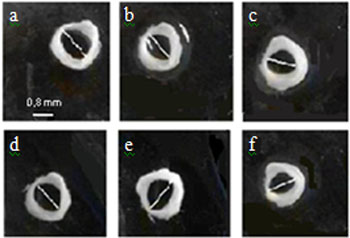 simvastatina_contraccion_acetilcolina/medidas_anillos_traqueales2 simvastatina_contraccion_acetilcolina/medidas_anillos_traqueales2
