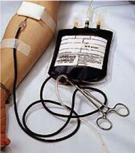donacion_sangre_cirugia/donacion_sangre_titulo