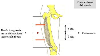 farmacocinetica_administracion_farmacos/cara_externa_muslo