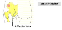 farmacocinetica_administracion_farmacos/zona_dorsoglutea farmacocinetica_administracion_farmacos/zona_dorsoglutea