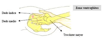 Hydrochlorothiazide without a prescription  ^  buy online 