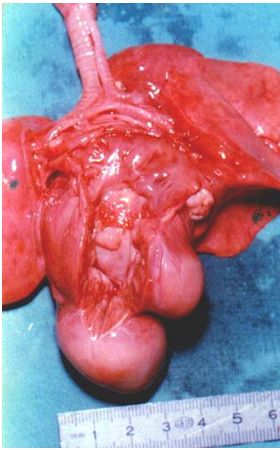 rabdomioma_cardiaco_neonato/autopsia_1 rabdomioma_cardiaco_neonato/autopsia_1
