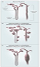 mecanismos_formacion