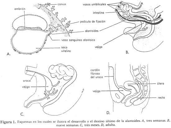 fistula_umbilicovesical_alantoides