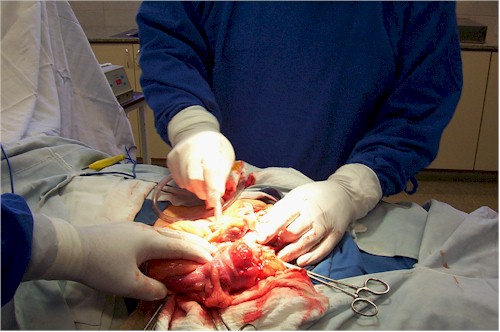 hernia_inguinoescrotal_cirugia hernia_inguinoescrotal_cirugia