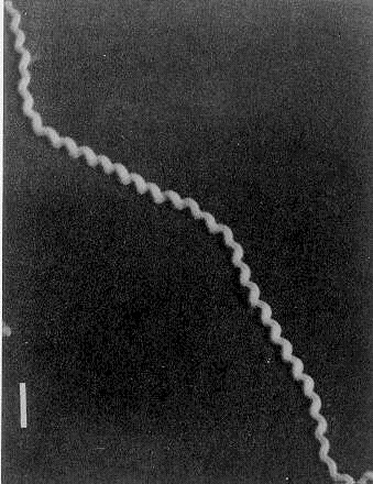 leptospira_interrogans_icterohaemorrhagiae3 leptospira_interrogans_icterohaemorrhagiae3