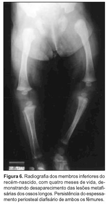 lesiones_esqueleticas lesiones_esqueleticas
