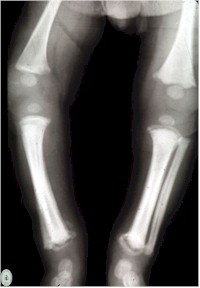 lesiones_esqueleticas2 lesiones_esqueleticas2