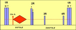 estenosis_aortica3 estenosis_aortica3
