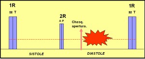 estenosis_tricuspidea2