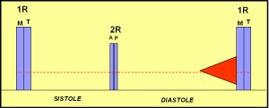 estenosis_tricuspidea3 estenosis_tricuspidea3