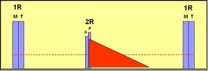 insuficiencia_aortica2 insuficiencia_aortica2
