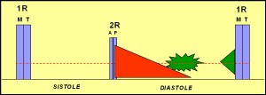 insuficiencia_aortica3 insuficiencia_aortica3