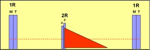 insuficiencia_pulmonar2