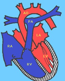 prolapso_mitral prolapso_mitral