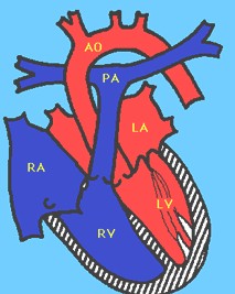 prolapso_mitral