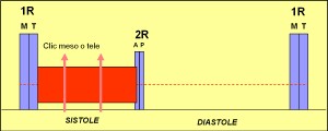 prolapso_mitral2 prolapso_mitral2