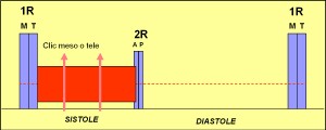 prolapso_mitral2