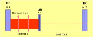 prolapso_mitral4 prolapso_mitral4