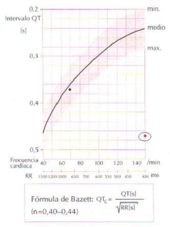 electrocardiograma_ECG_QT/ECG_EKG_intervalo_QT_3 electrocardiograma_ECG_QT/ECG_EKG_intervalo_QT_3
