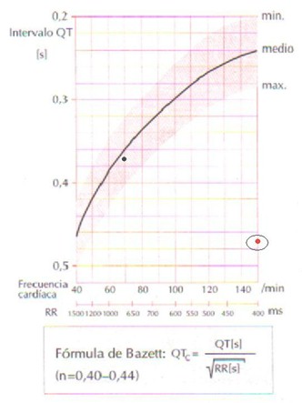 electrocardiograma_ECG_QT/ECG_EKG_intervalo_QT_3