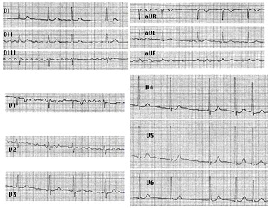 emergencias/guia_urgencia_fibrilacion_auricular